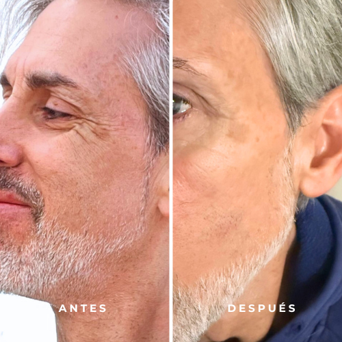 SET GOLD | Sérum Facial 3-en-1 + Contorno de Ojos - Imagen 4