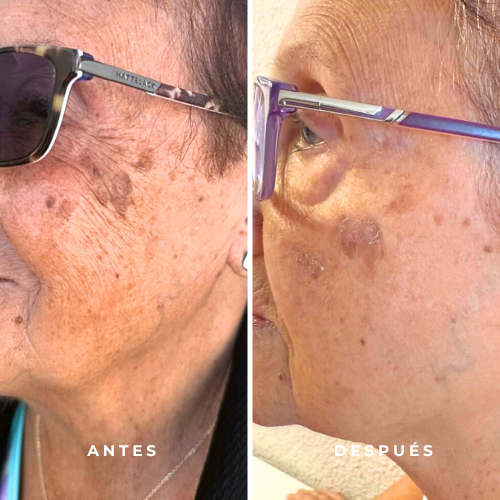 SET EMERALD | Crema Despigmentante + Sérum Facial 3-en-1 - Imagen 6