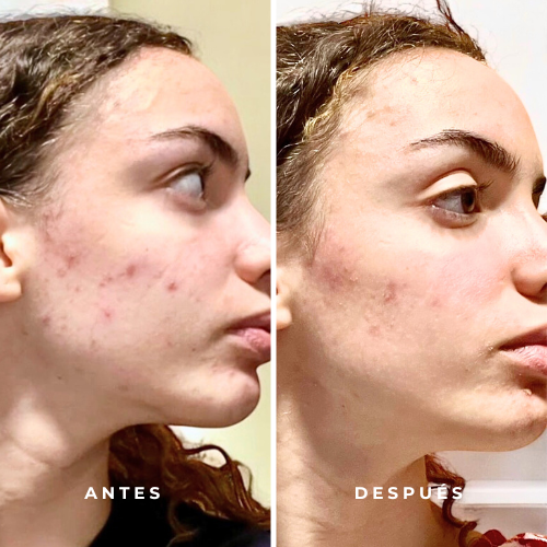 SÉRUM FACIAL 3 EN 1| REGENERADOR ILUMINADOR ANTI-AGE - Imagen 4