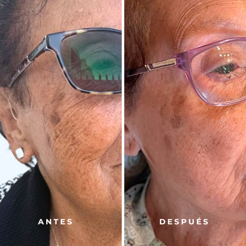CREMA FACIAL | DESPIGMENTANTE ANTI-AGE - Imagen 7
