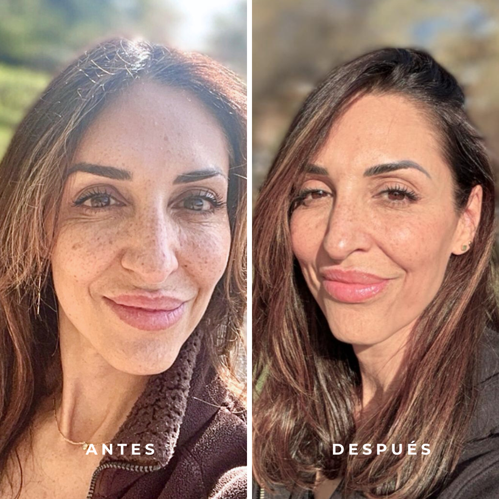 SET PLATINUM | Contorno de Ojos + Sérum Facial 3 en 1 + Crema Despigmentante Antiedad - Imagen 7